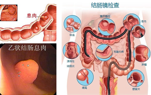 萎縮性胃炎真的“很嚇人”？看完這“七個事實”你就明白了